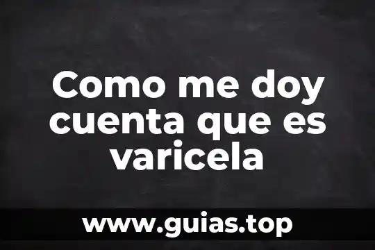 Que es una cuenta o cheque 6 Como me doy cuenta que es varicela