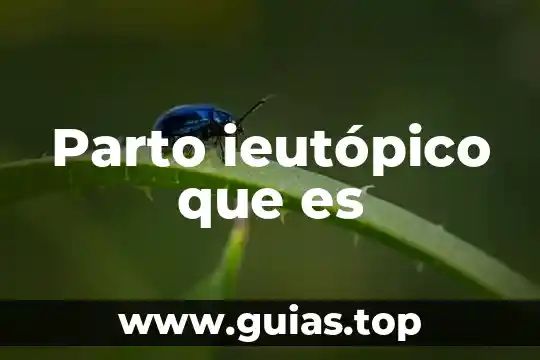 Que es sala de parto 8 Parto ieutópico que es