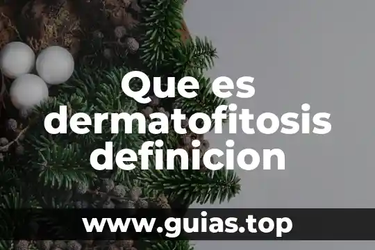 Que es el absolutismo definicion 3 Que es dermatofitosis definicion