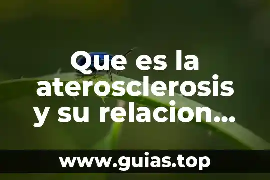Qué es la relación hipótesis y supuesto jurídico 5 Que es la aterosclerosis y su relacion con el colesterol