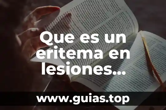 Que es una fuente de informacion primarias 7 Que es un eritema en lesiones primarias