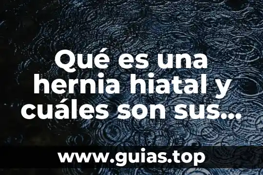 Que es temperamento y cuales son sus tipos 4 Qué es una hernia hiatal y cuáles son sus síntomas